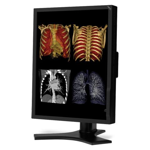 手勢平板：服務(wù)醫(yī)療行業(yè)的創(chuàng)新數(shù)字標(biāo)牌應(yīng)用,信息顯示系統(tǒng),多媒體信息發(fā)布系統(tǒng),數(shù)字標(biāo)牌,數(shù)字告示，digital signage