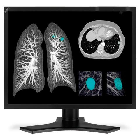 手勢平板：服務(wù)醫(yī)療行業(yè)的創(chuàng)新數(shù)字標(biāo)牌應(yīng)用,信息顯示系統(tǒng),多媒體信息發(fā)布系統(tǒng),數(shù)字標(biāo)牌,數(shù)字告示，digital signage